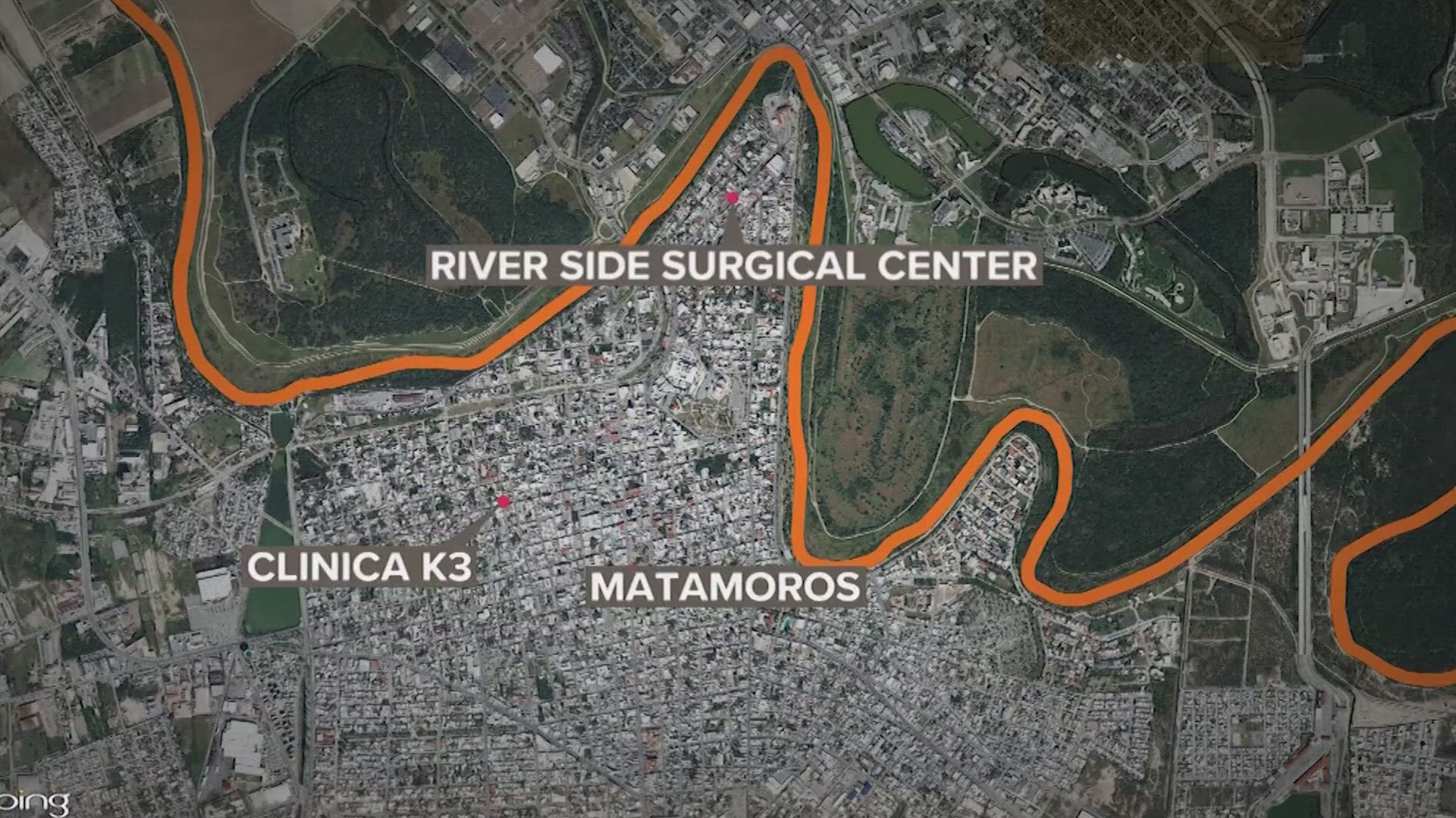 The CDC says anyone who got surgery with an epidural in Matamoros this year should see medical care immediately.