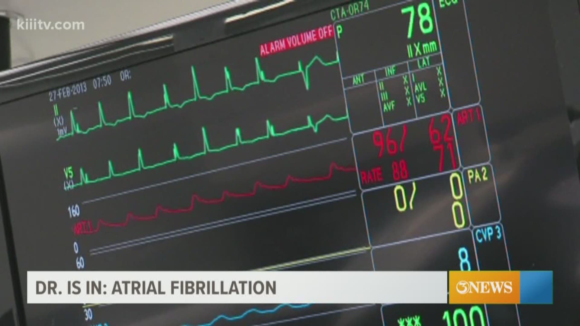 Blood clots, stroke and heart failure can all be tied to atrial fibrillation.