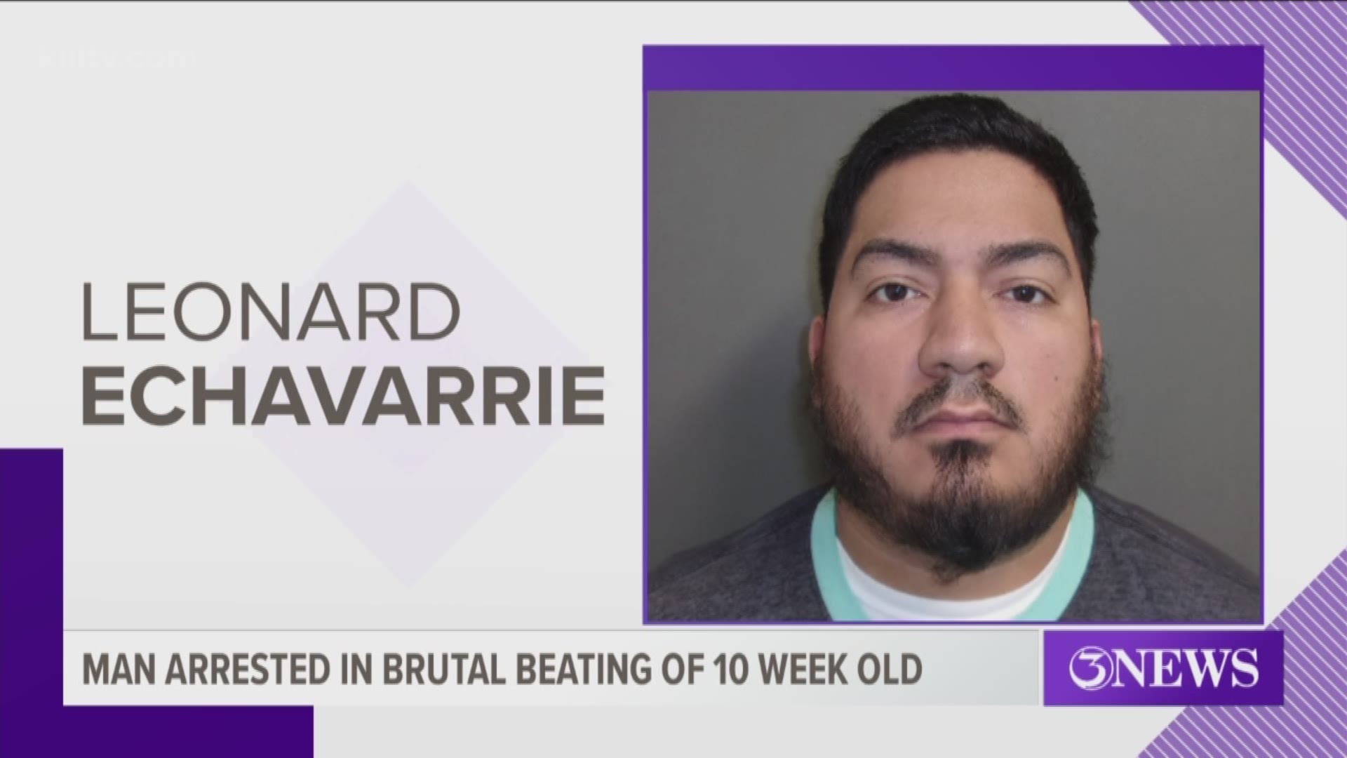 A 10-week-old girl in San Patricio County is now on life support being treated for bleeding in the brain after police say she was brutally beat by her father.