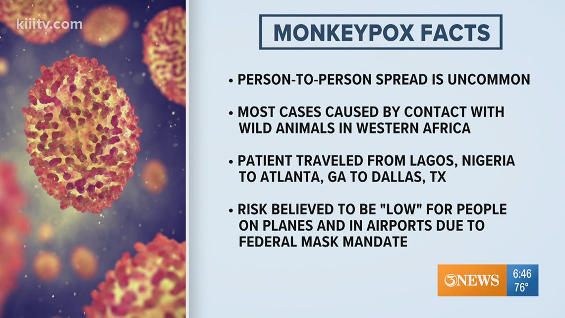 Monkeypox in Texas