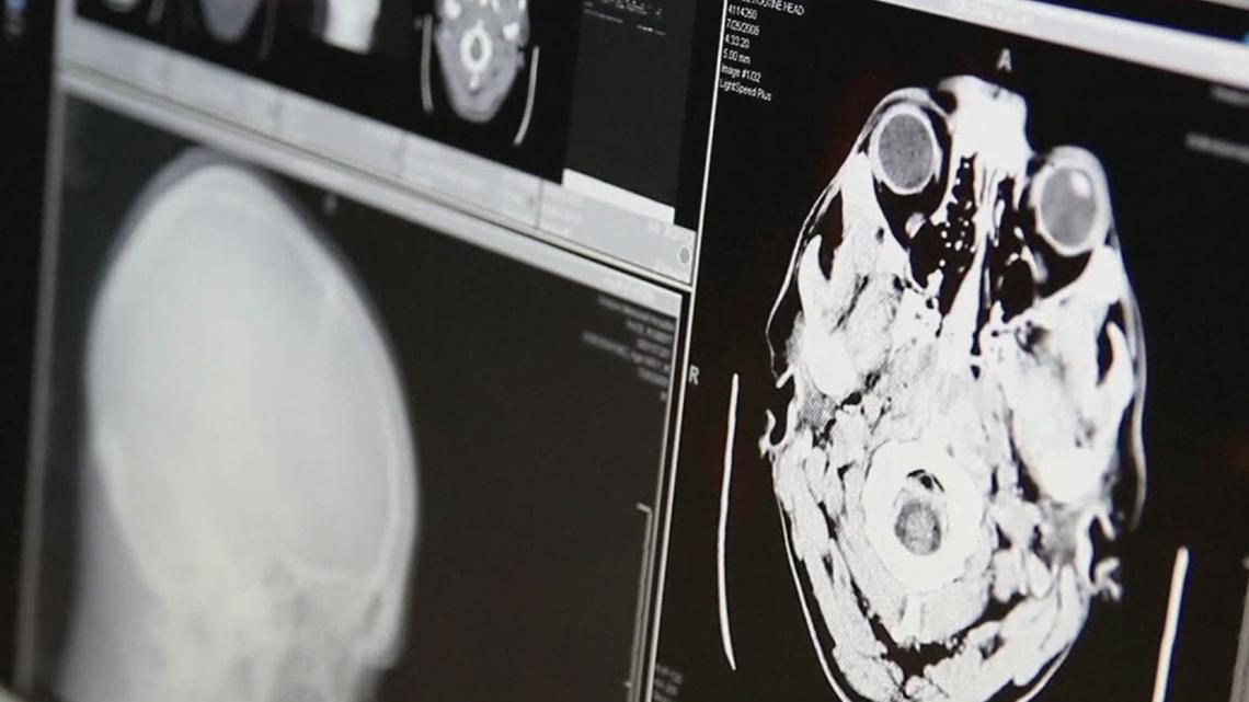 $3B in state funding for dementia research halted by lawsuit