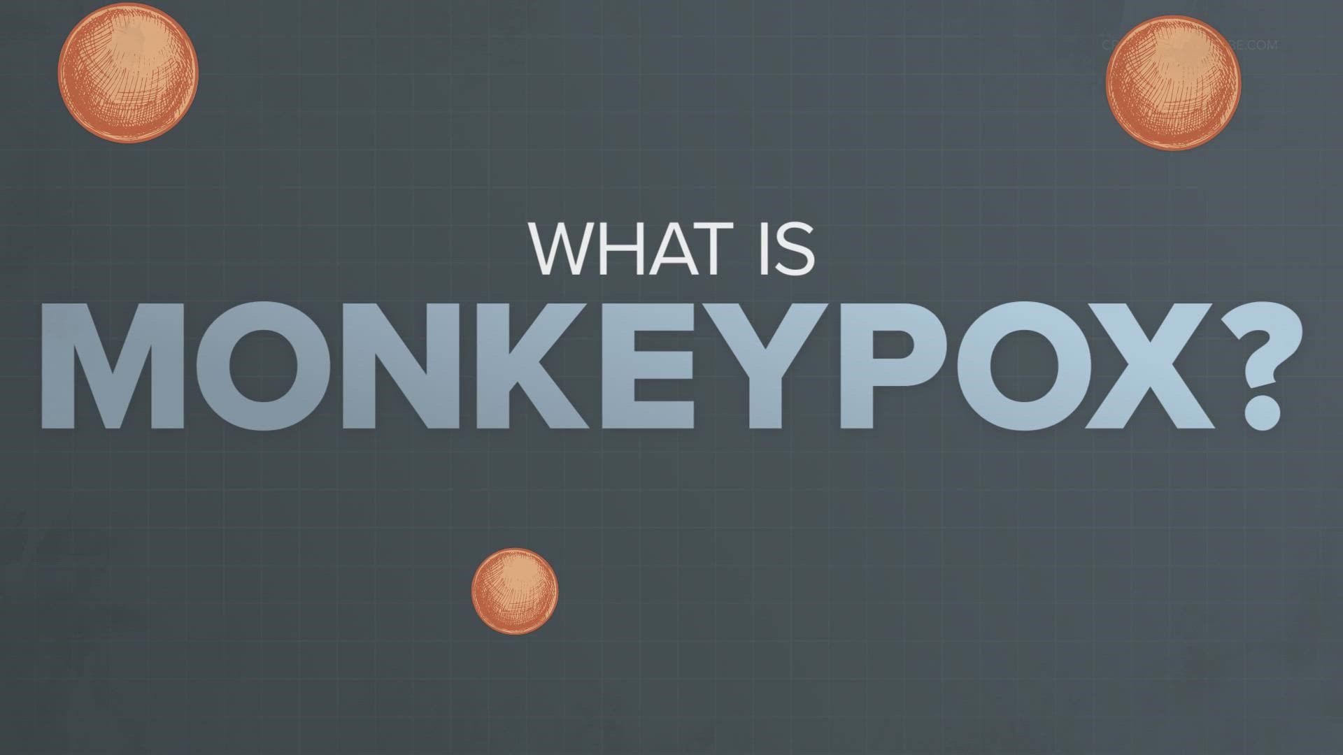 Monkeypox continues to spread in Texas, but what is it? We explain.