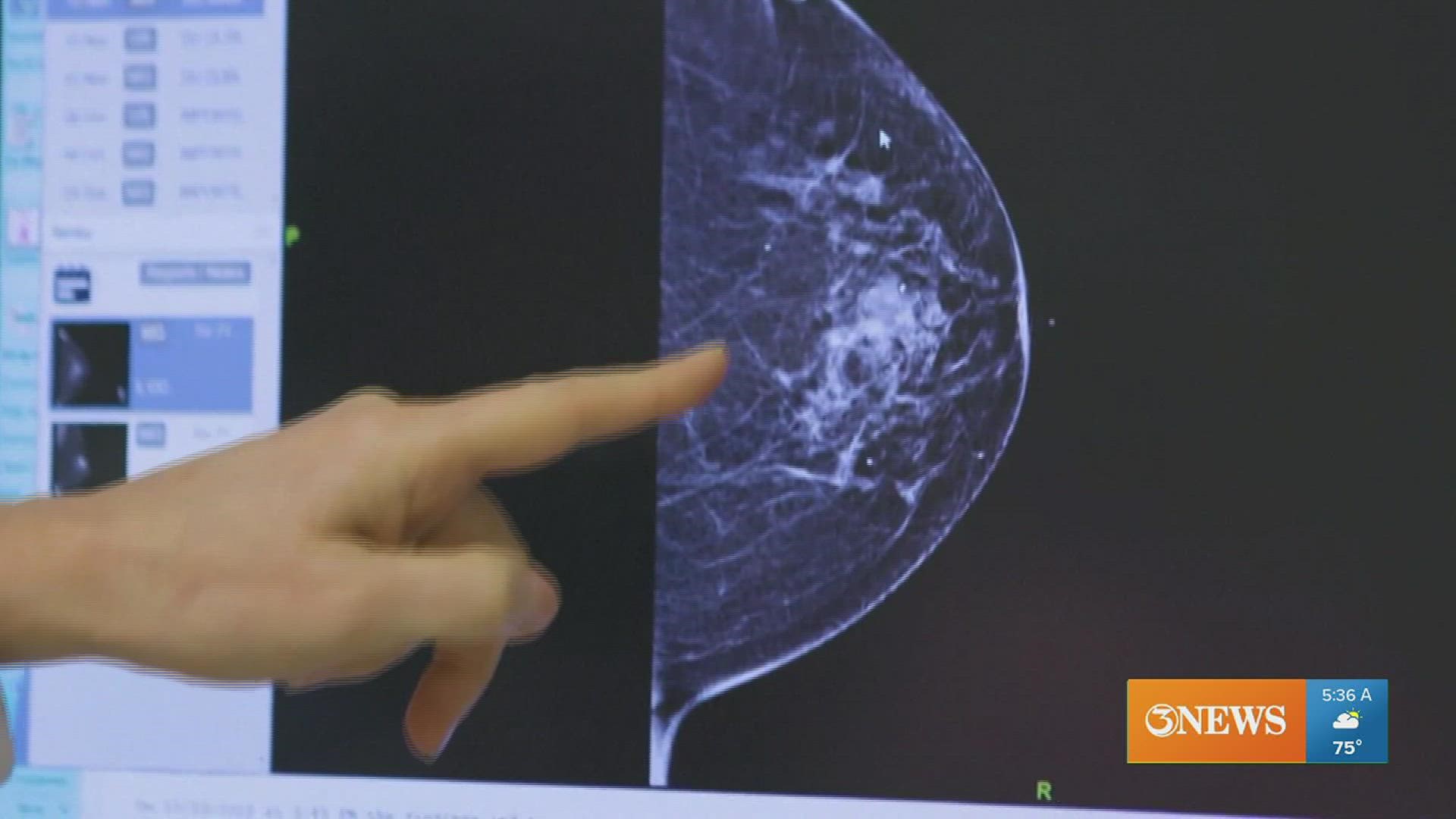 Breast Cancer Now - The earlier breast cancer is diagnosed, the