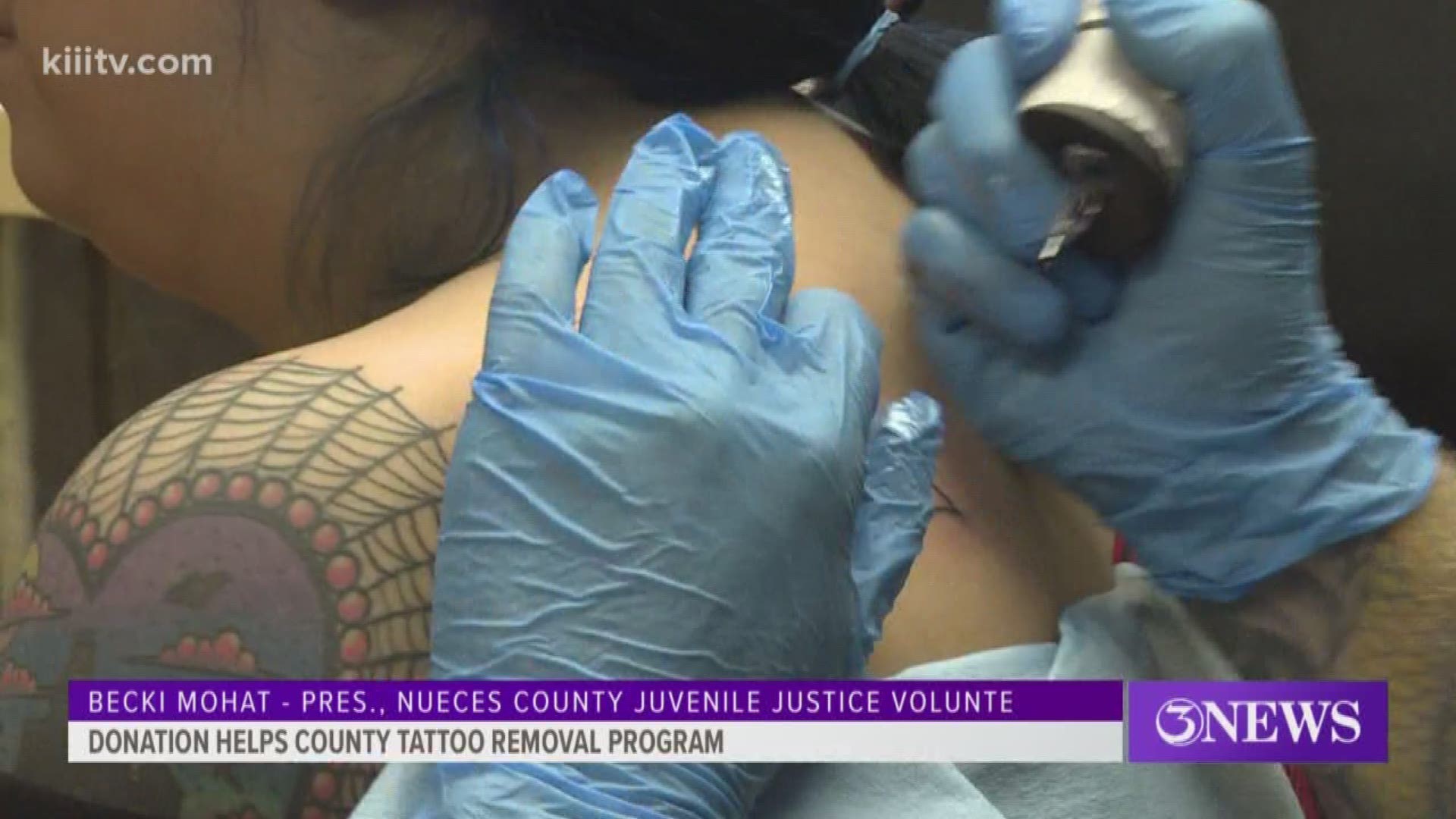 El Dorado County Probation Partnered with Ink Doctors for a Free Tattoo  Removal Event - Chief Probation Officers of California