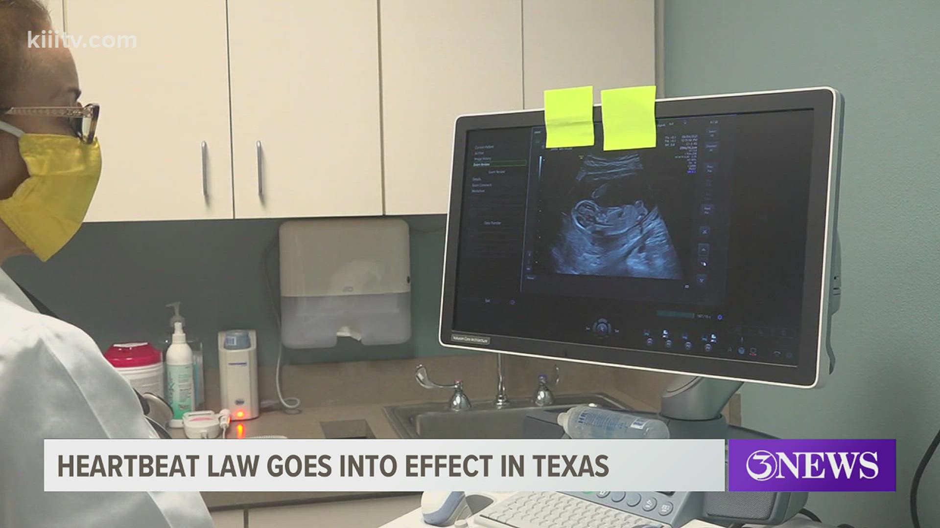The law bans abortions once a fetal heartbeat is detected, which for some, could be as early as six weeks.