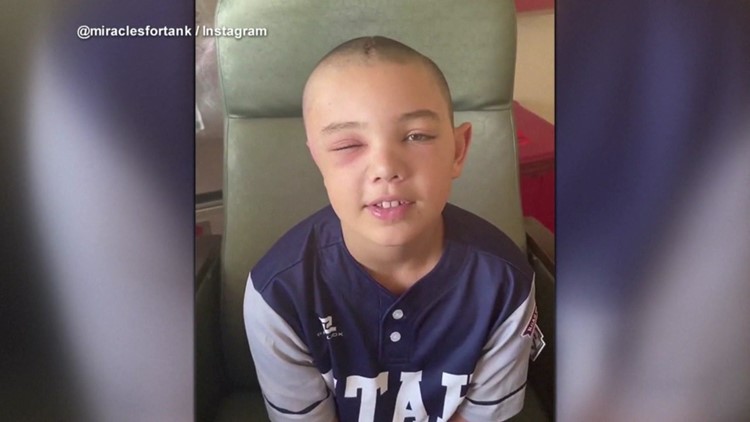 Little League, bunk bed maker sued by injured player's family